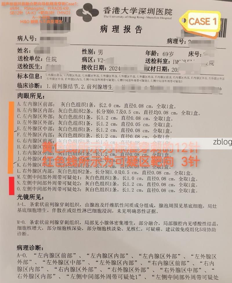 2022年8月15日桑日县新增确诊病例情况_17103