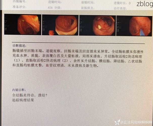 【2022年3月15日利津县新增确诊病例情况_20077】