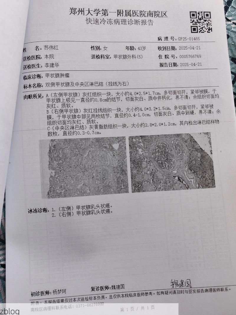 【2022年5月28日遵化新增确诊病例情况_21963】