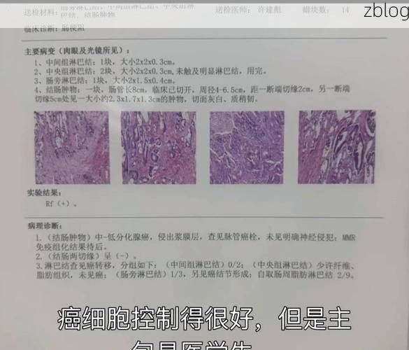 本地确诊+2，汉寿通报新增病例情况