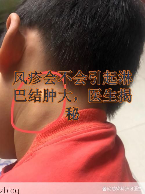 印江土家族苗族自治县新增1例无症状感染者  印江土家族苗族自治县疫情防控最新通报