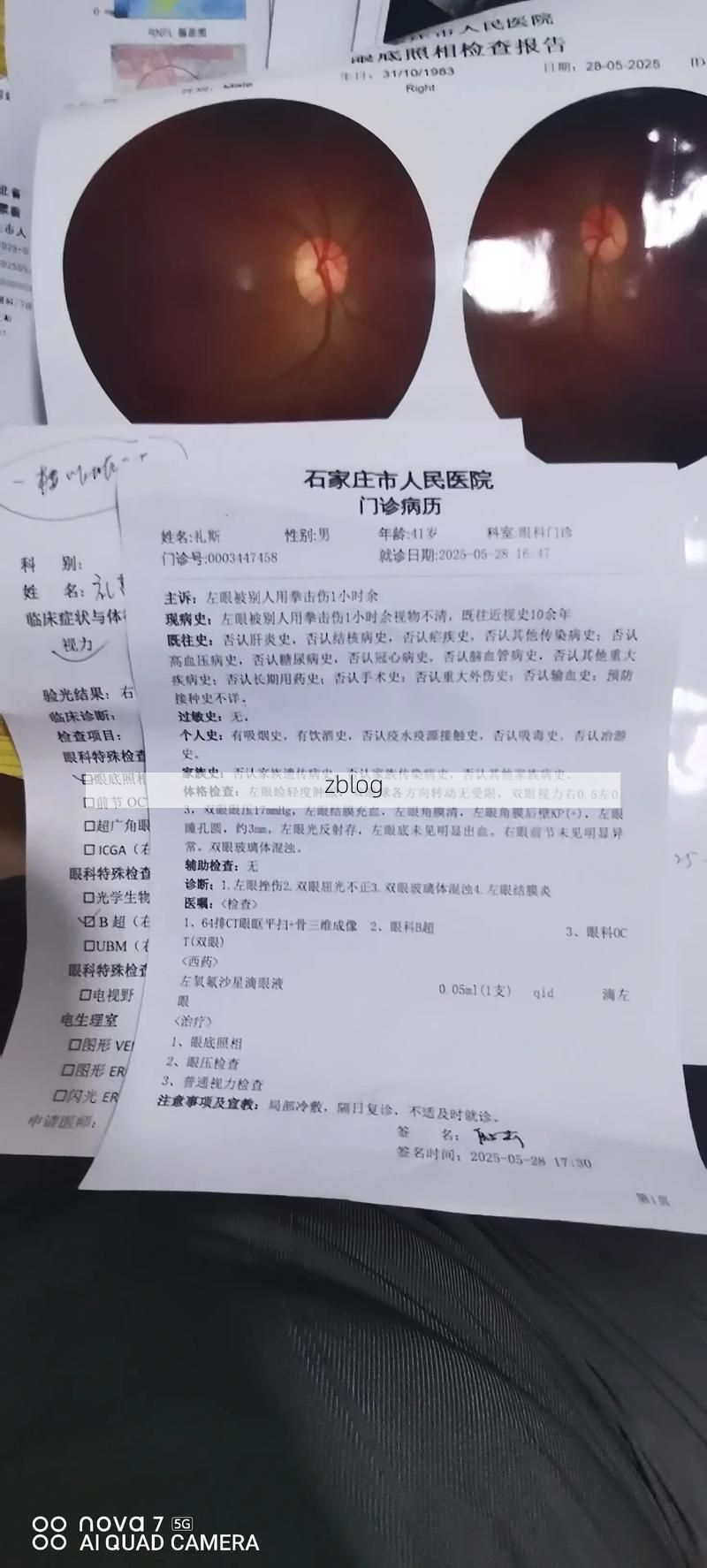 2022年11月25日巧家县新增确诊病例情况_78534