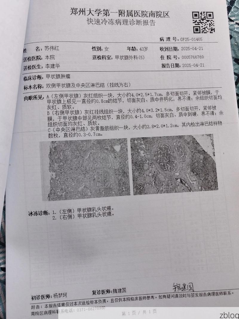 2022年3月15日巨野县新增确诊病例情况