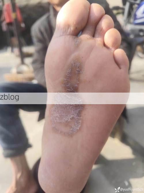 景谷：滇南雨林屏障下的低感染样本