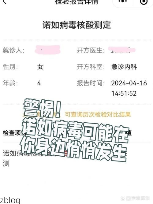 郫县新增1例无症状感染者  郫县发布疫情防控最新通报_58888