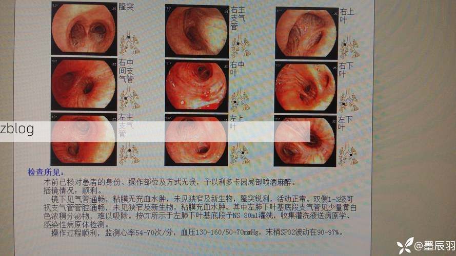 铜仁：武陵屏障下的低感染区样本