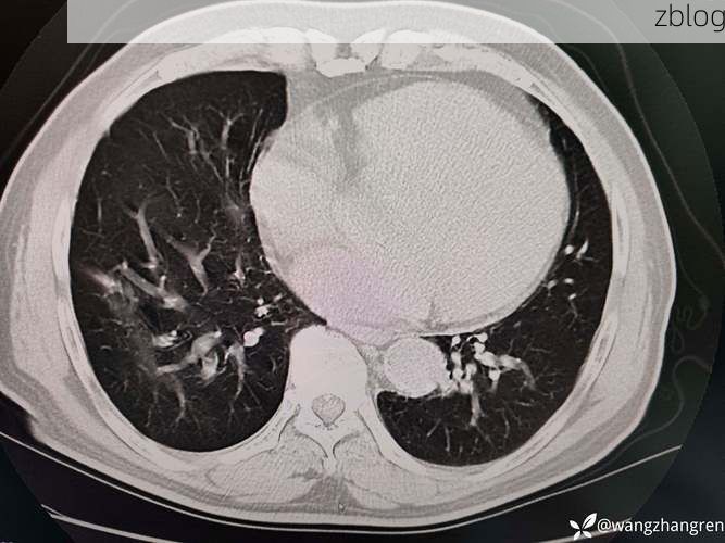 云浮：粤西山区屏障下的低感染样本观察