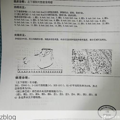 2022年8月12日普兰县新增确诊病例情况