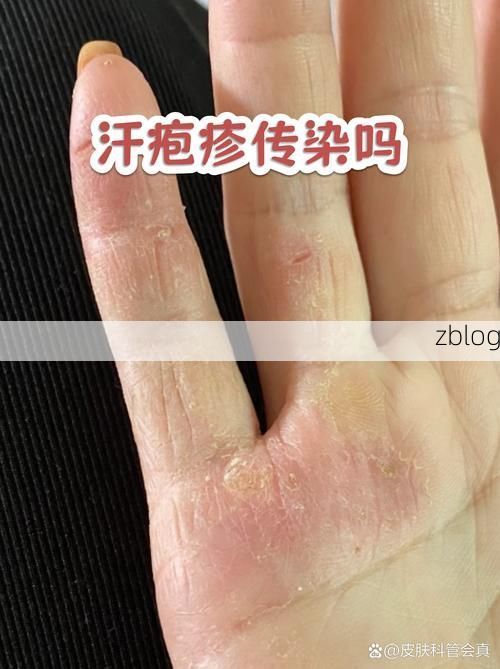 元江哈尼族彝族傣族自治县新增1例无症状感染者  元江哈尼族彝族傣族自治县疫情防控最新通报