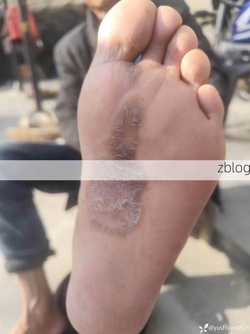 长汀：闽西山区屏障下的低感染样本观察_55163