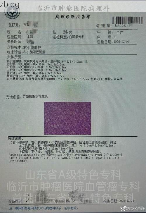 2022年3月25日双柏新增确诊病例情况_49358