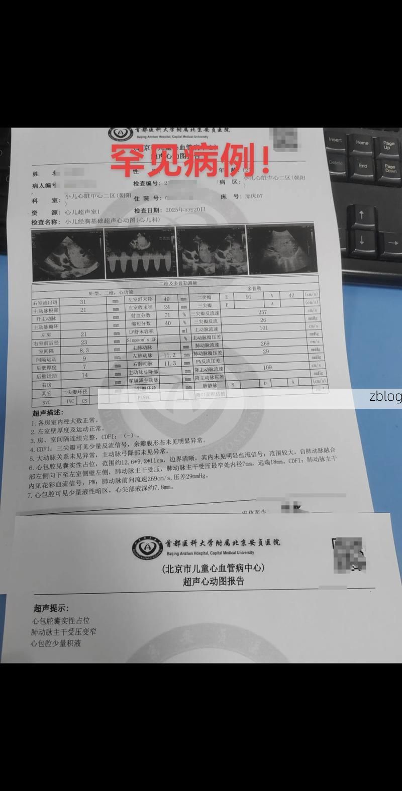 2022年11月25日巴州区新增确诊病例情况
