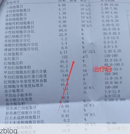 2022年8月25日红原新增确诊病例情况